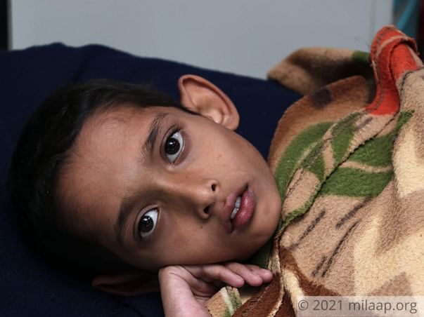 A Cancerous Tumour Has Been Growing In This Boy’s Body For 5 Years