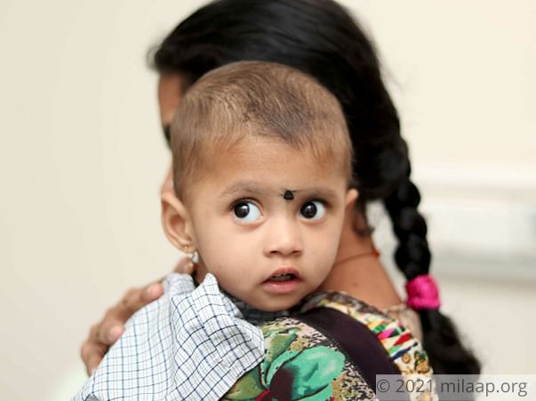Her Parents' Poverty May Not Let This Baby Girl Get A Healthy Liver