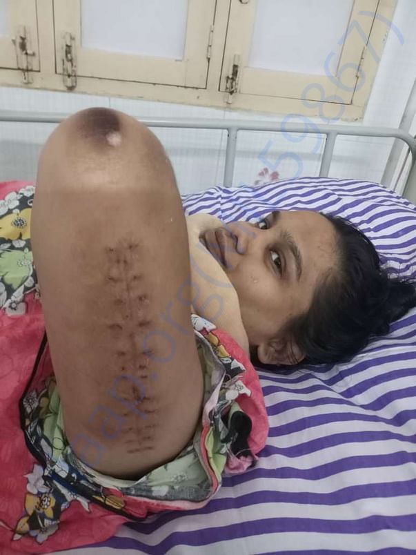 Recent pic of my friend ..... Recovering slowly