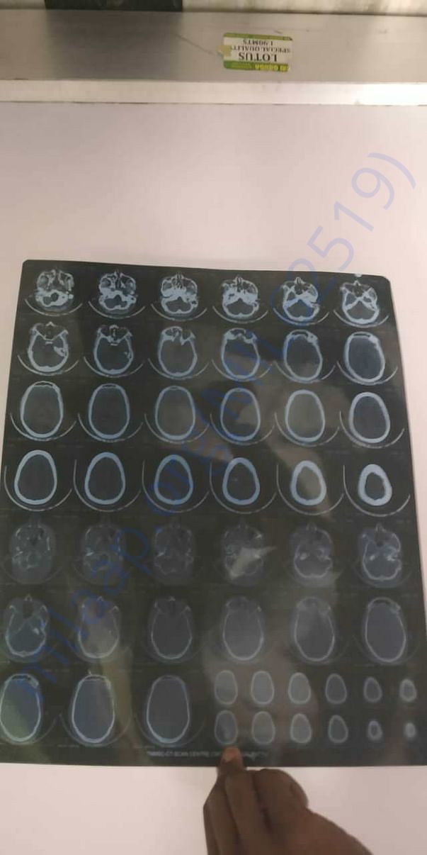 Scan report