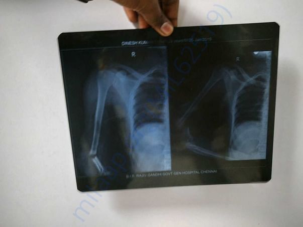 Scan report for hand
