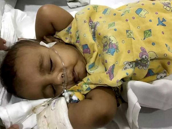 Help Baby Hafiz Undergo Open Heart Surgery