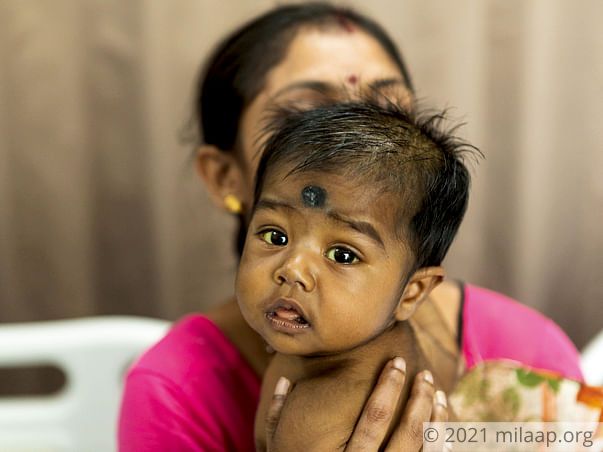 Baby Rajashree needs your help to undergo Liver transplant