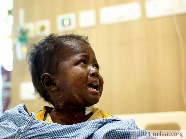 2-year-old May Die Of Cancer Because He Does Not Have An Aadhar Card