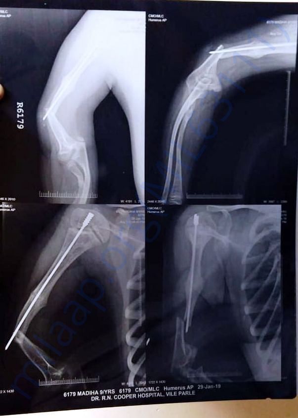 Madiha Shaikh X-ray Report Of Right Hand