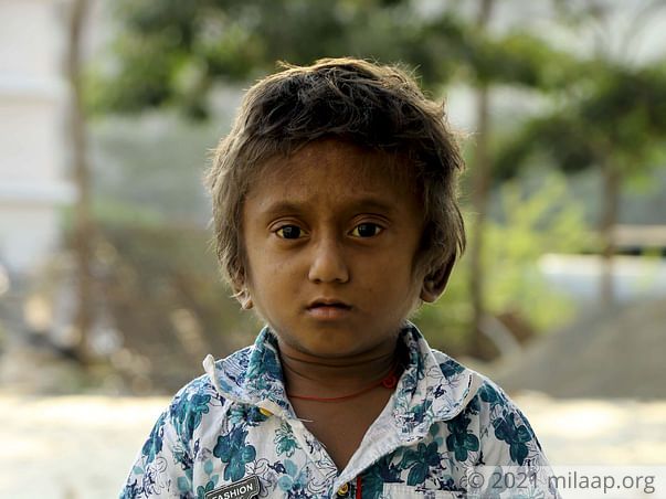 Badukonda needs your help to undergo liver transplant