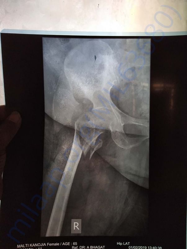 Xray