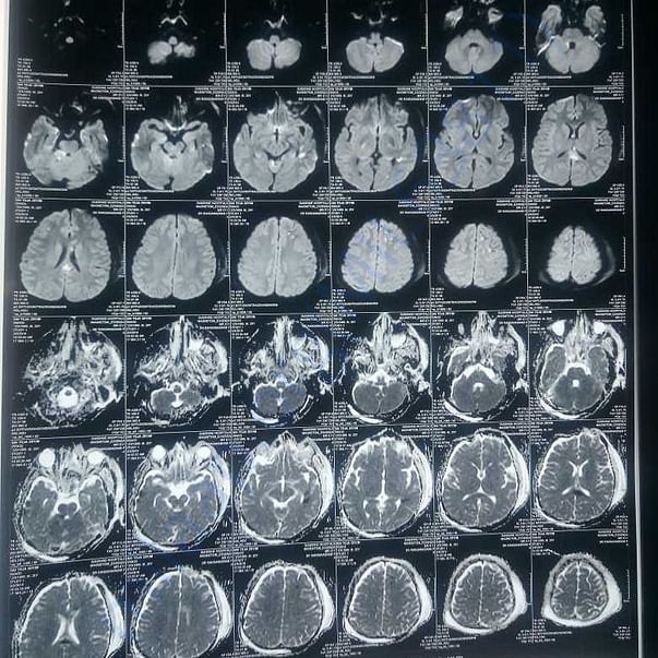 Medical Report