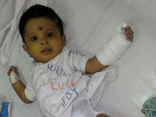 Help Seven month old Baby Ved with Liver failure