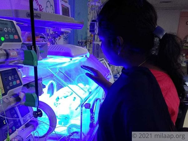 Baby of Vinod needs your help to survive