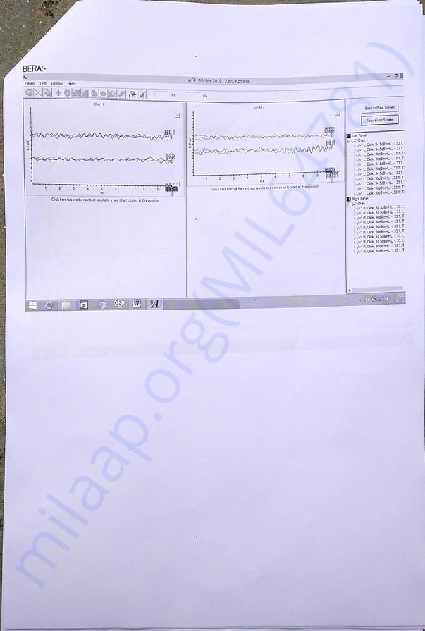 Hearing test 4