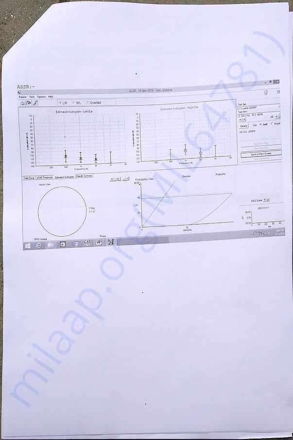 Hearing test 5