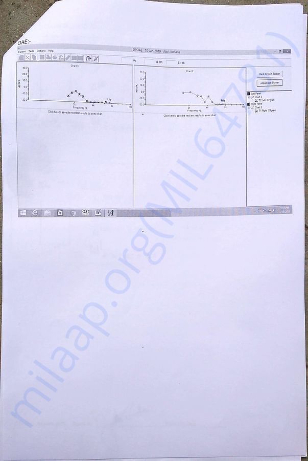 Hearing test 6