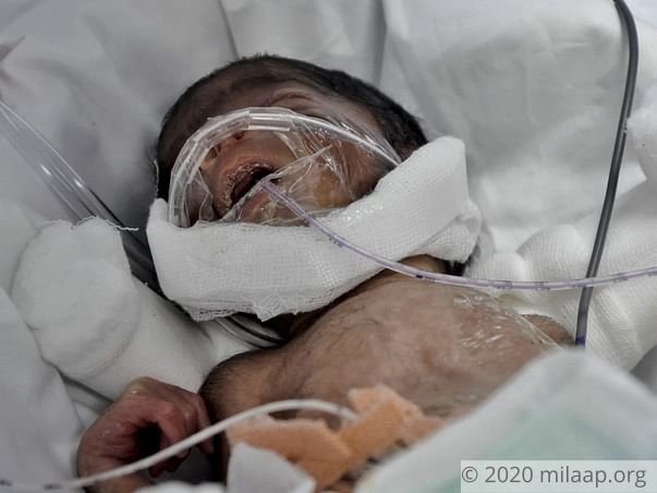 Bangle Seller Needs Your Help To Save His Newborn Baby
