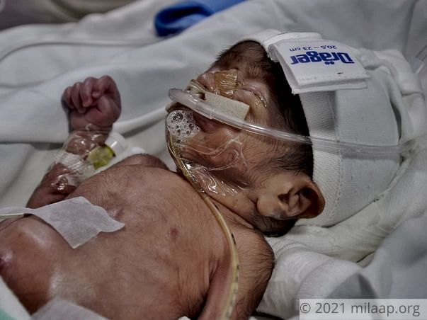 Baby of Latha needs your help to survive