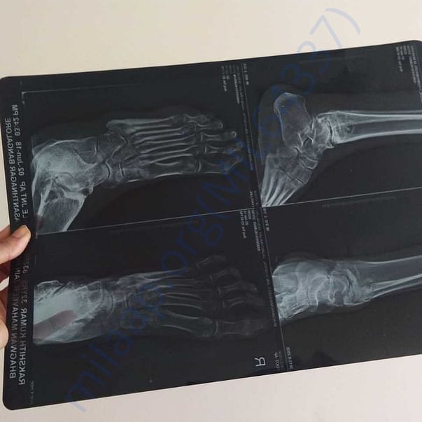 Medical Report