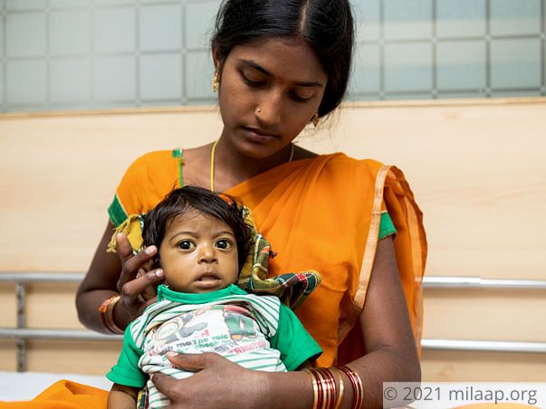Baby of Sarojini Biliary Atresia with Chronic Liver Disease