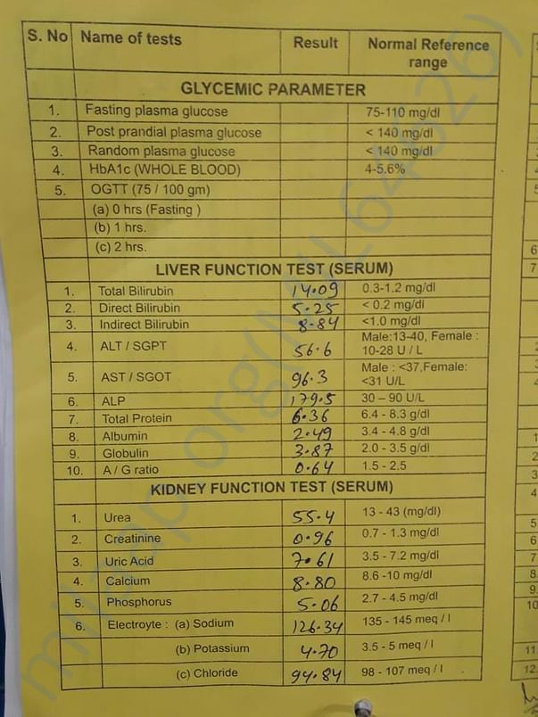 Lever report