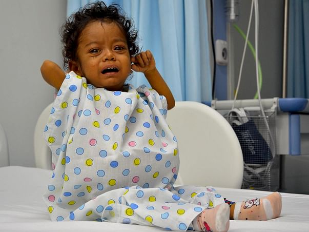 This 1-Year-Old's Life Depends On A Liver Transplant, You Can Help Him