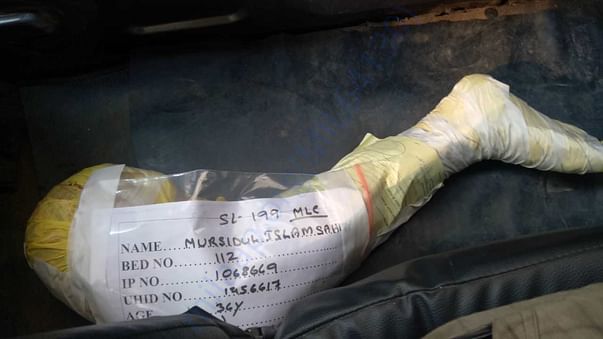 Leg which lost its way...
