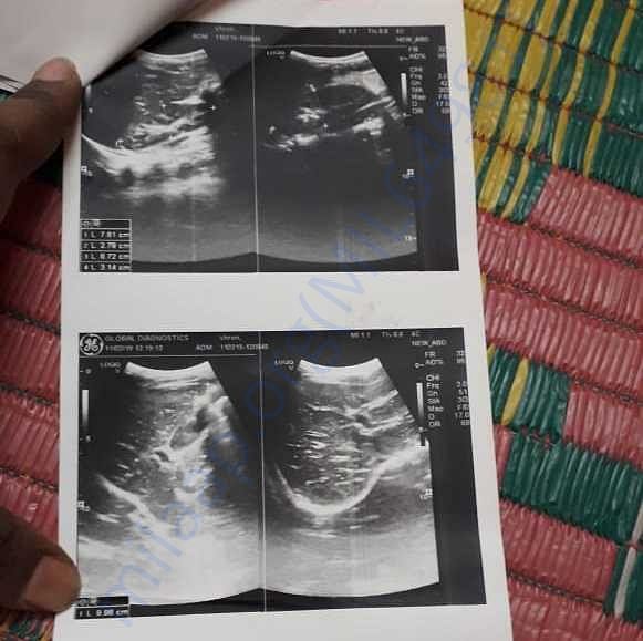 Medical Report