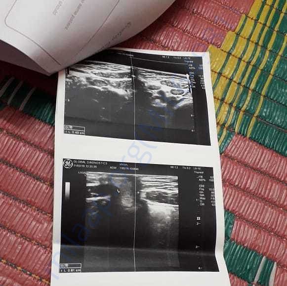 Medical Report