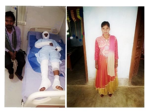 Help Burn Survivor Pratima Get Married
