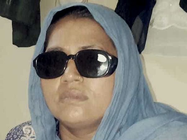 My mother eye operation