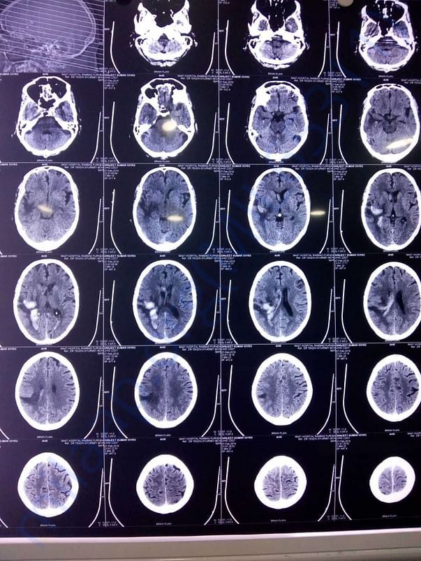Brain Scan
