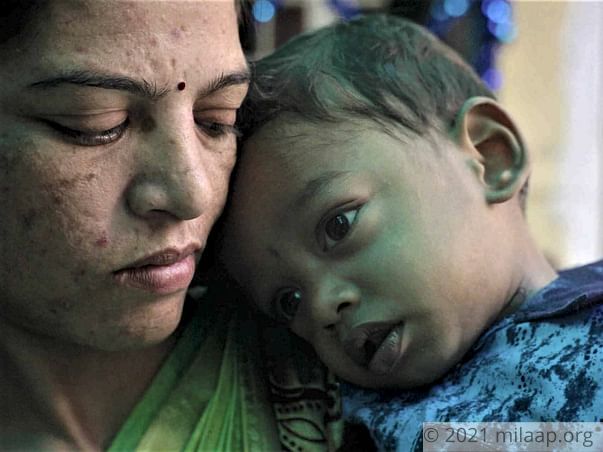 Parents Starve To Feed 1-Year-Old Who Could Die Of Malnutrition