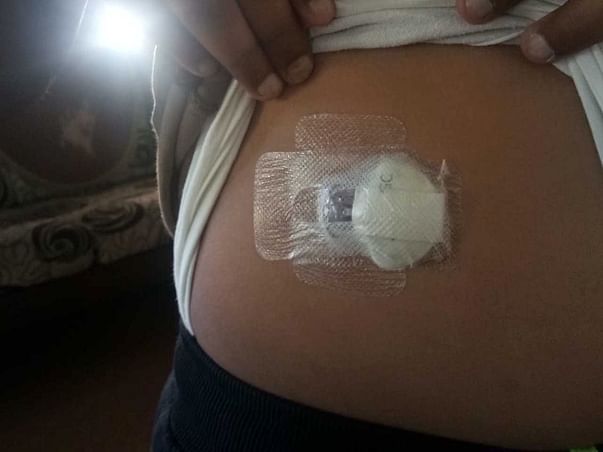 Help Shruthvidh Undergo Treatment For Type 1 Diabetes.