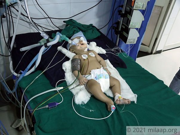 You Can Save This 4-Month-Old Baby Boy From Brain Damage