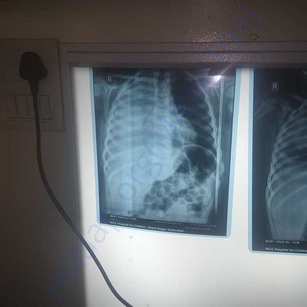 Medical Report