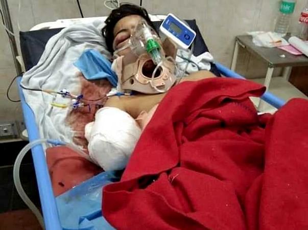 Help 14-Year-old Devansh Recover From A Major Train Accident