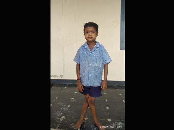 Help Naveen And Praveen Fight Kidney Disease.