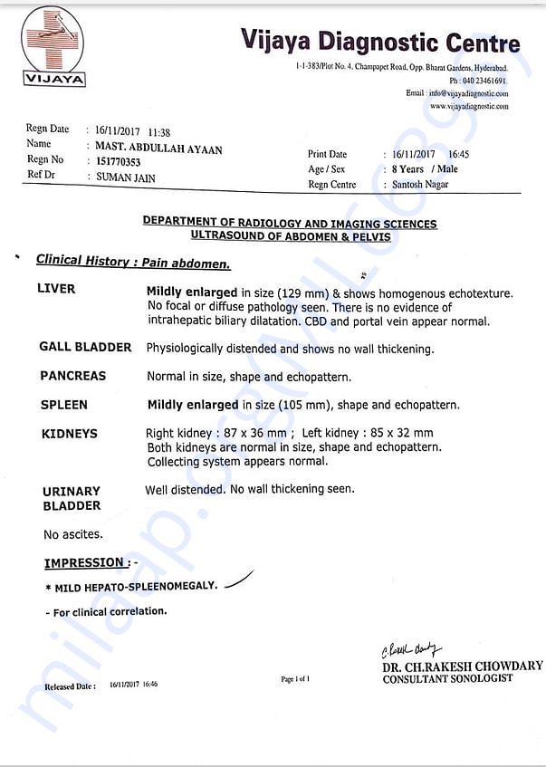 Liver enlarged due to regular blood transfusion