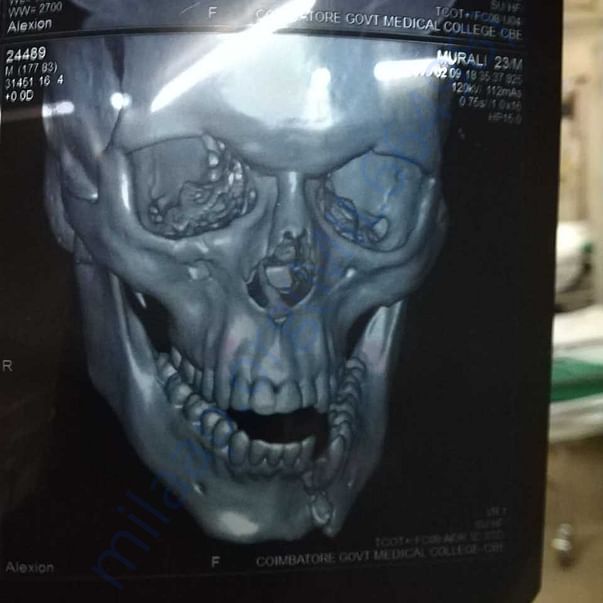 Medical Report