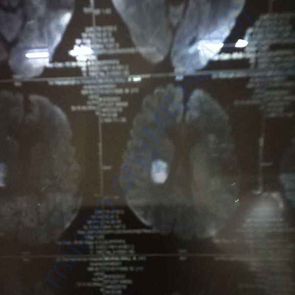 Medical Report