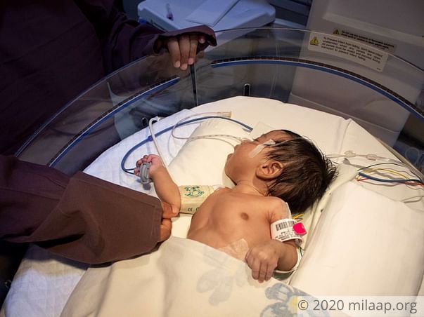 24 Hours To Keep This Newborn Baby's Heart Beating