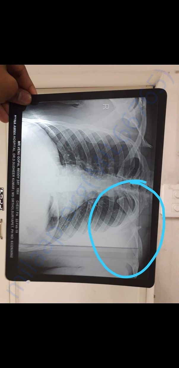 Xray