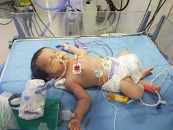 Help My New Born Baby Fight Lung Disease