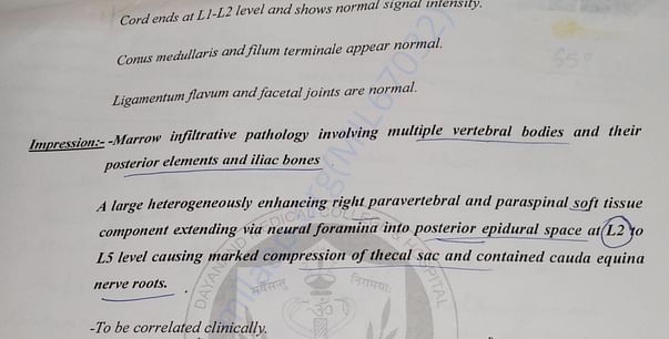 MRI Report of Mohan Krishan