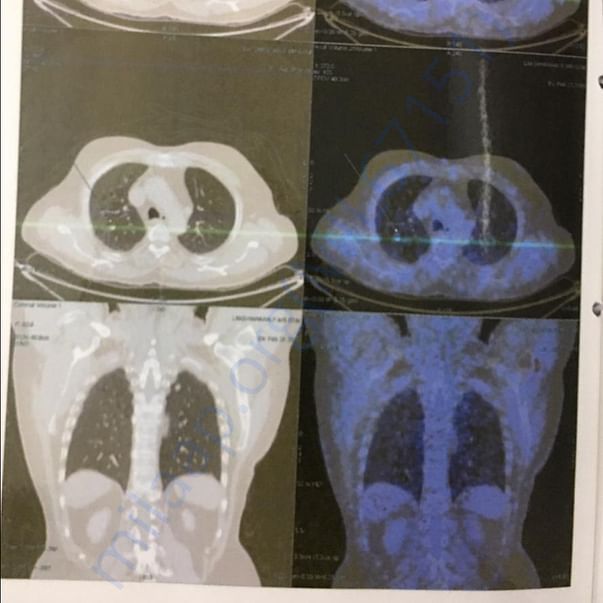 Medical Report