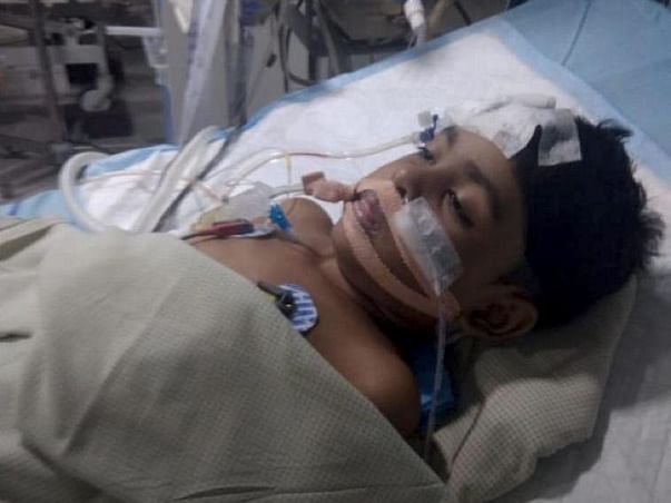 Help baby davathi to undergo brain tumour surgery