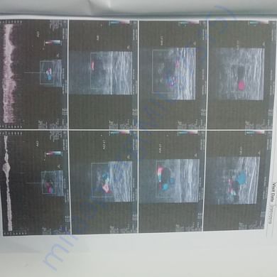 Scan Report
