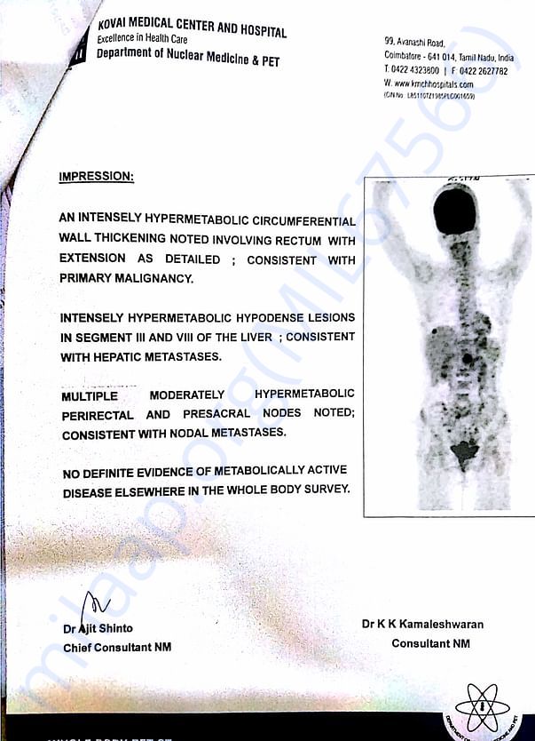 Pet scan. Report