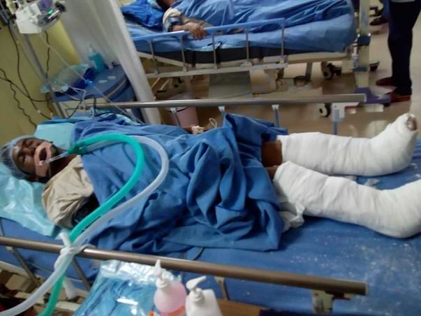 Lying on hospital bed lifeless in coma with both his legs broken
