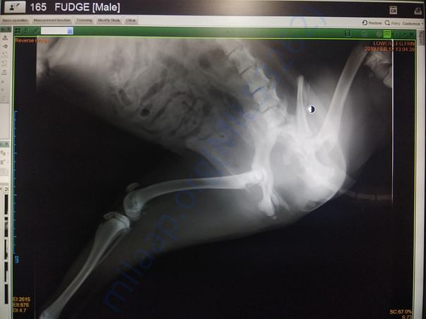 Xray showing fractured femur