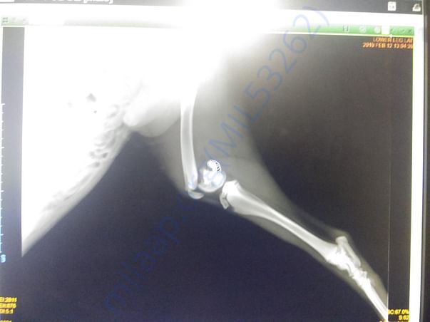 Xray of hip joint fracture