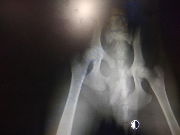 Pelvis AP view xray